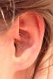 Daith heart